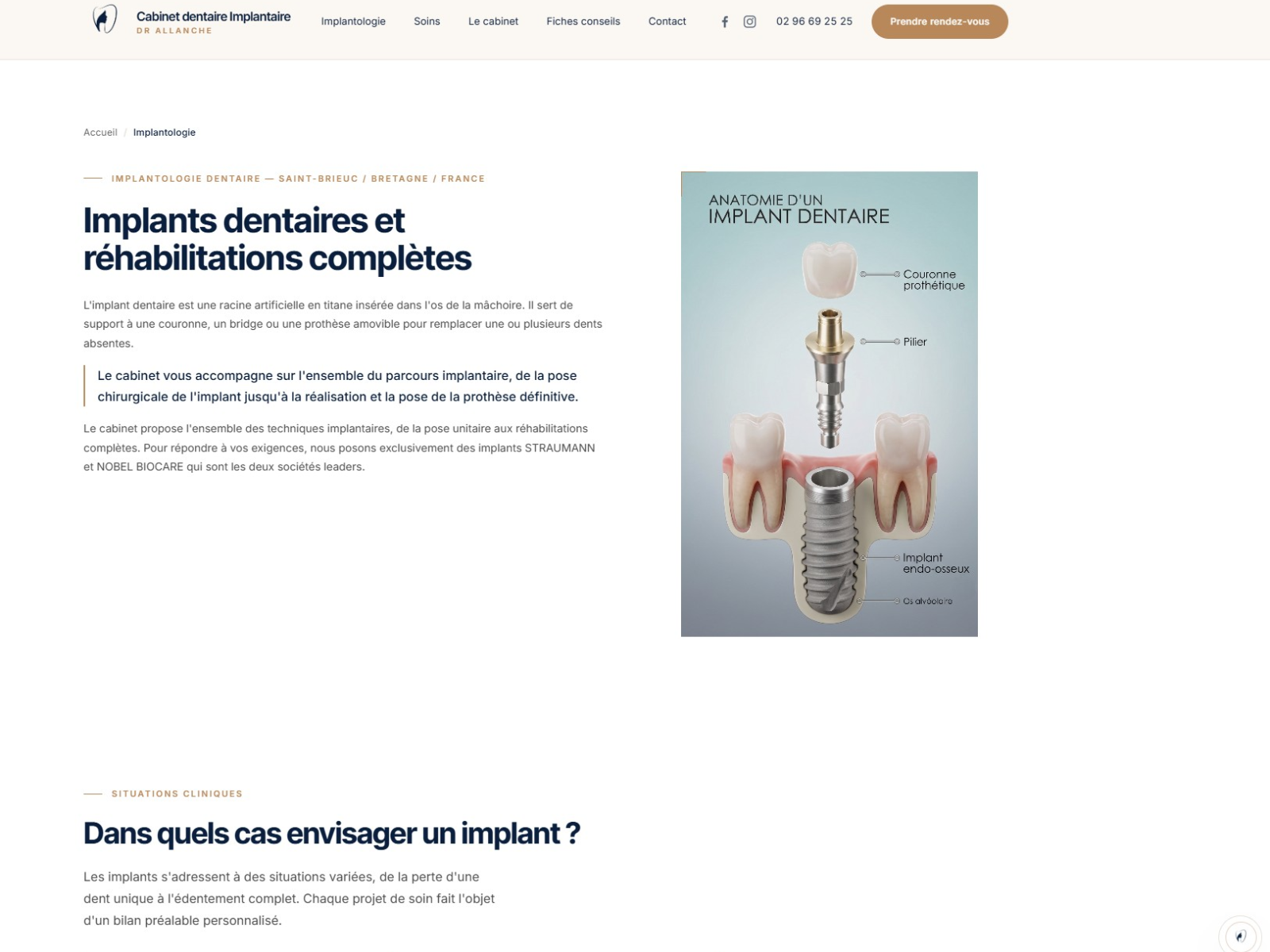 Aperçu du site Dr Claude ALLANCHE réalisé par BZH Com